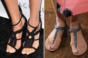 sandals for people with bunions