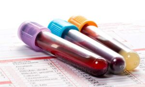 Live Blood Analysis Melbourne